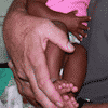 Dominican Republic medical mission trips